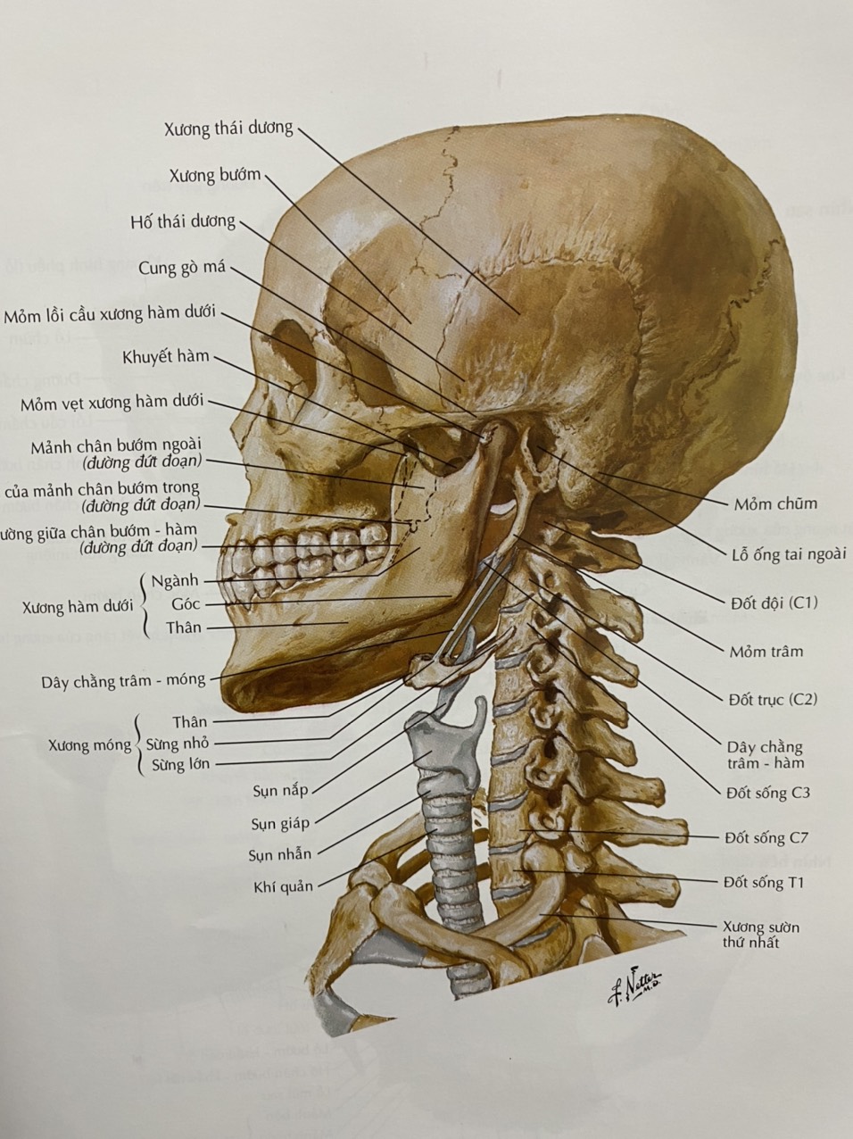 Viêm Khớp Thái Dương Hàm  ( phương pháp cấy chỉ )